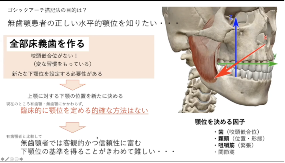 その下顎位をどう決める? [新品]