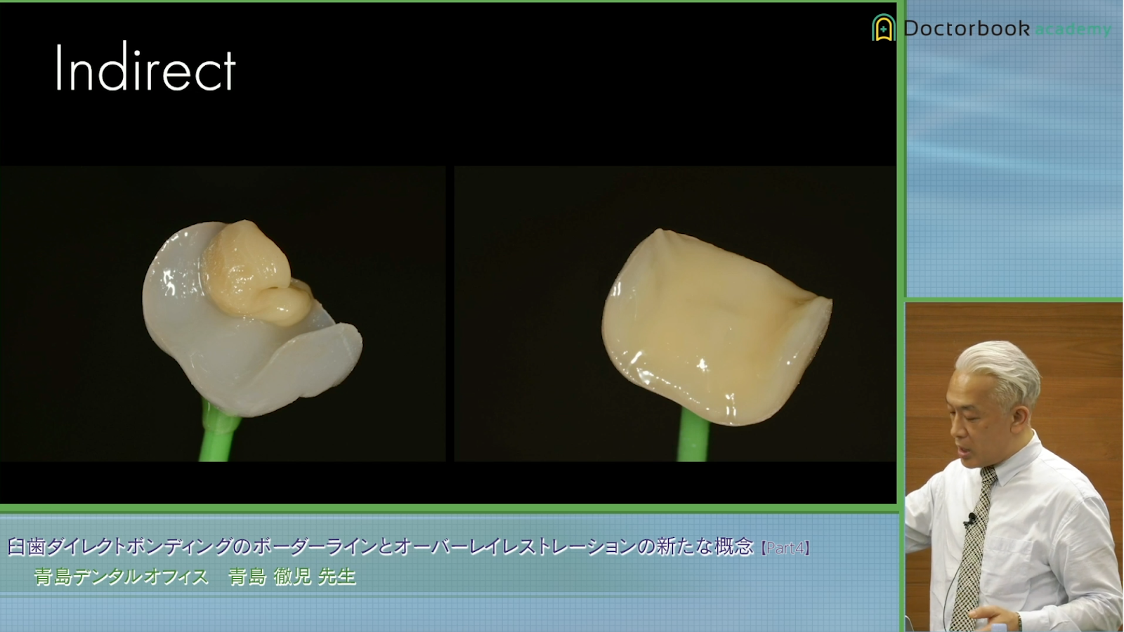 レジンの盛り方