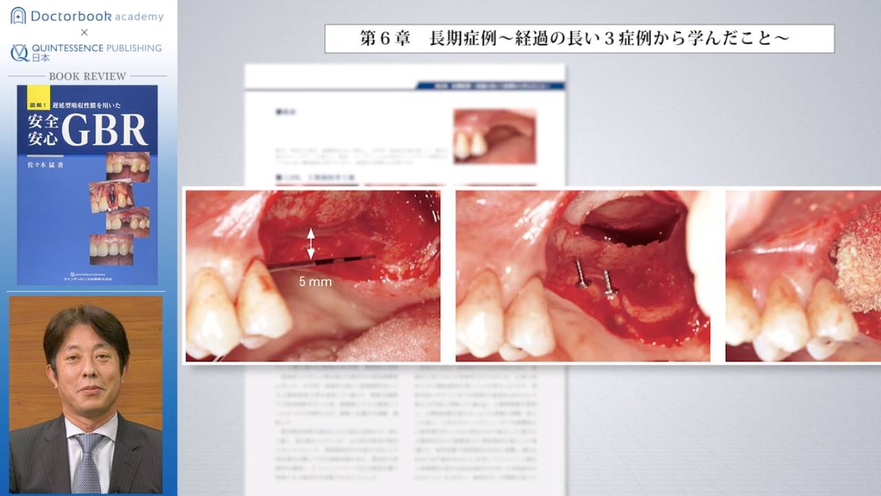 2020年1月】人気動画再生ランキング【TOP5】 | Doctorbook academy