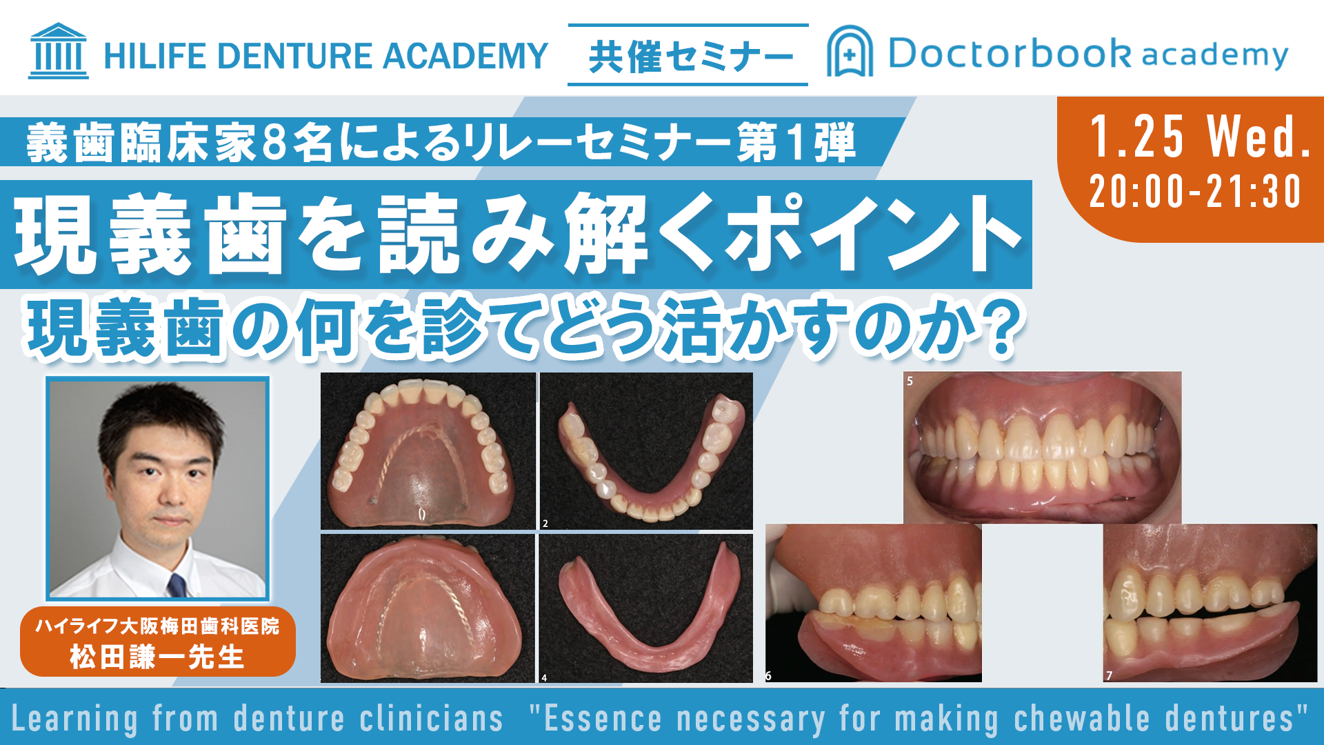 現義歯を読み解くポイント~現義歯の何を診てどう活かすのか~