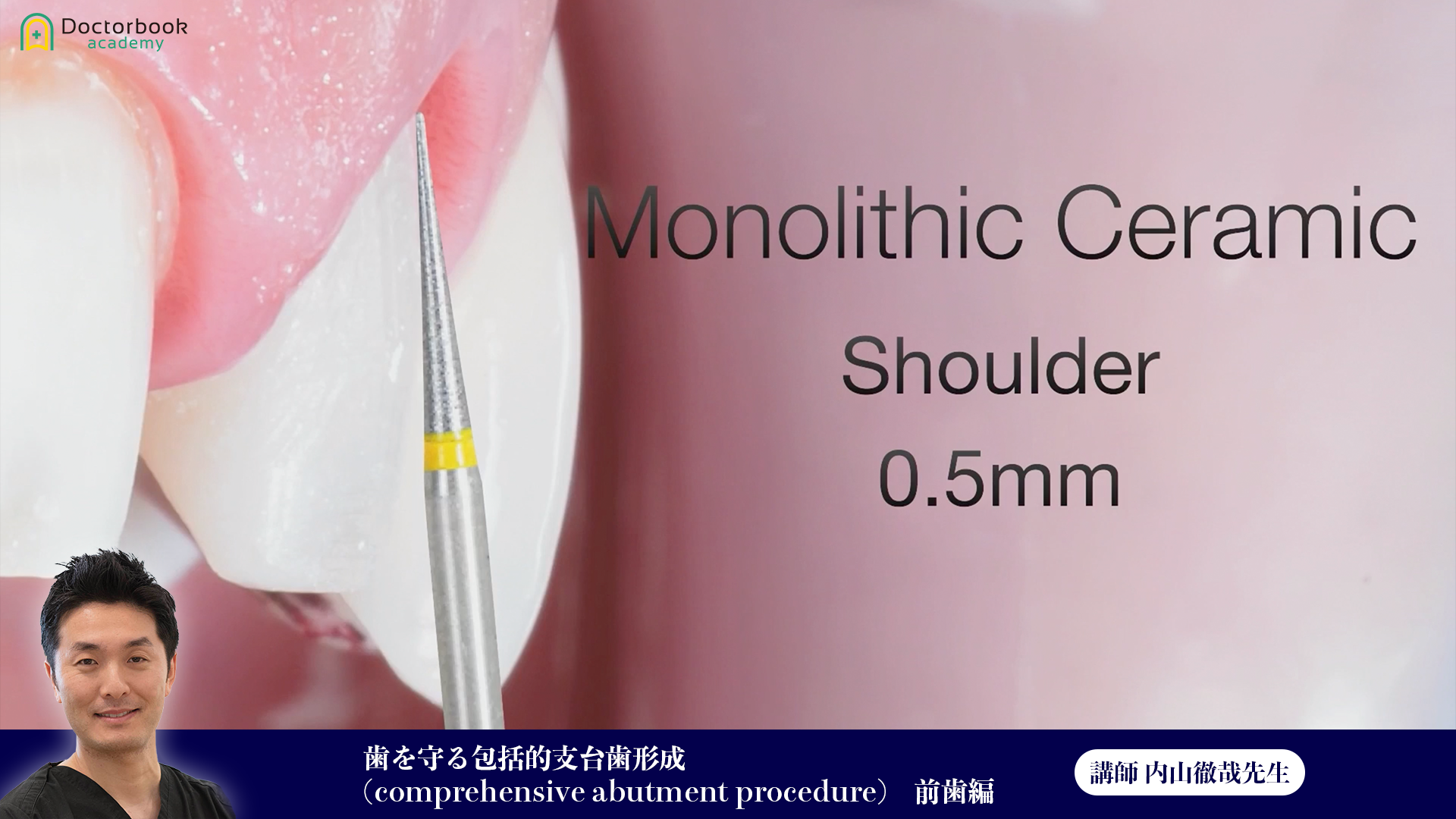 ⑱歯を守る包括的支台歯形成(comprehensive abutment procedure) 前歯編