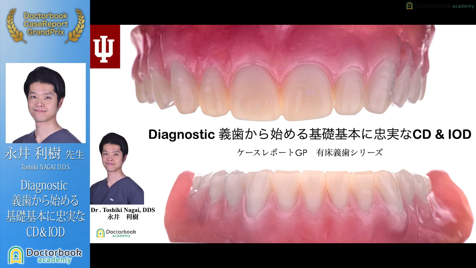 No.3 永井利樹先生「Diagnostic 義歯から始める基礎基本に忠実なCD&IOD」【ケースレポートGP有床義歯セッション】