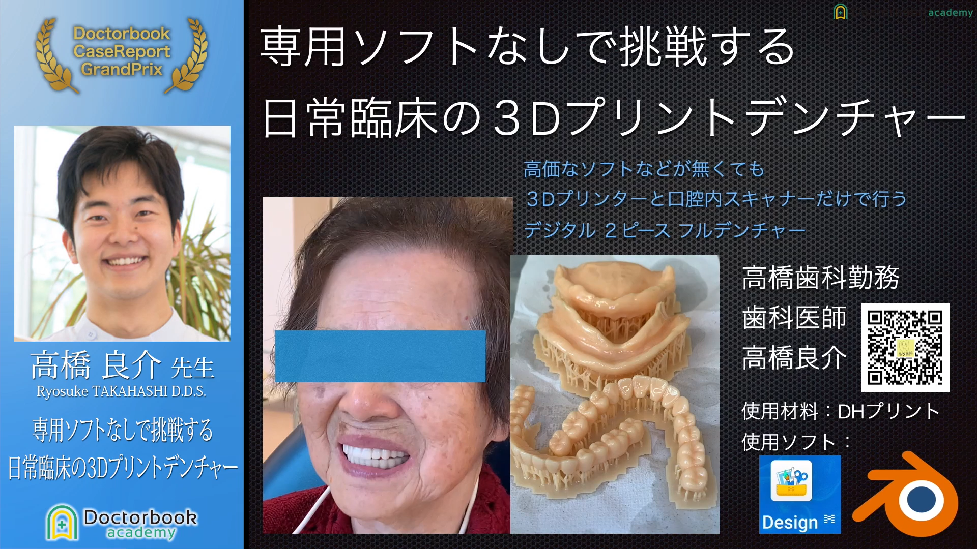 No.2 高橋良介先生「専用ソフトなしで挑戦する日常臨床の3Dプリントデンチャー」【ケースレポートGP有床義歯セッション】