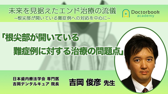 根尖部が開いている難症例に対する治療の問題点