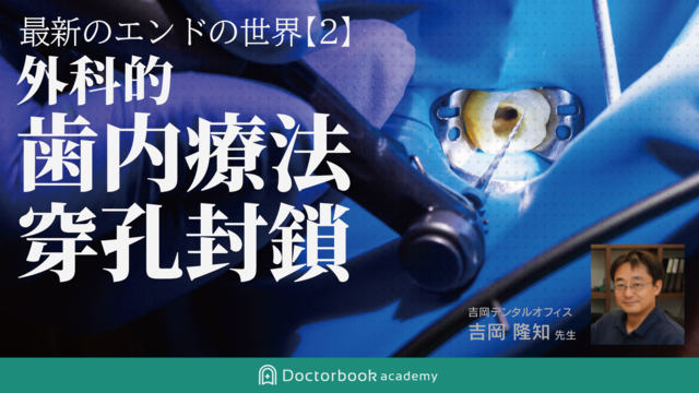 最新のエンドの世界 [2] - 外科的歯内療法・穿孔封鎖 -