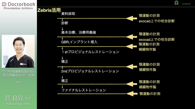 デジタル顎運動装置を用い咬合再構成をした一症例