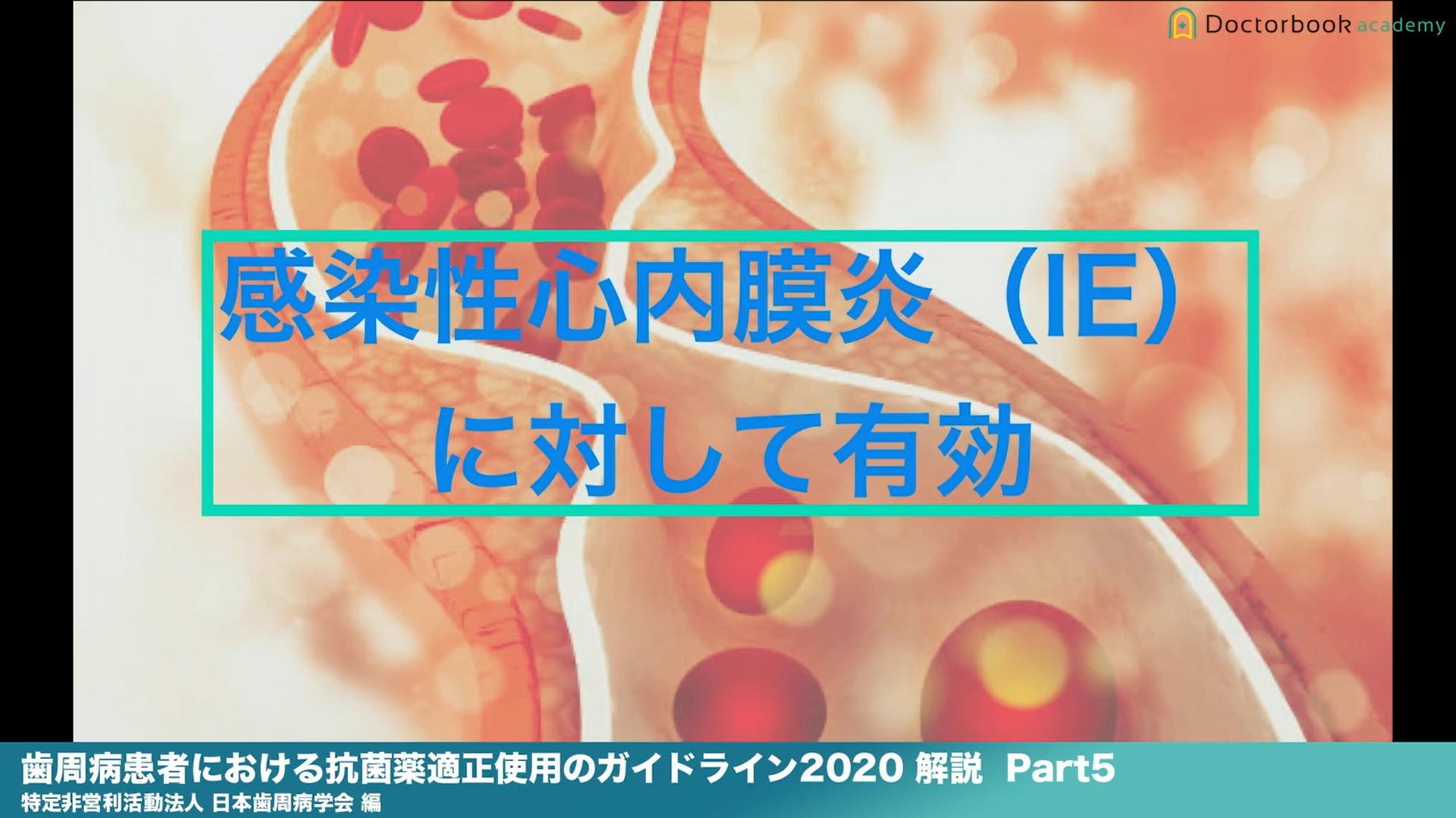 『歯周病患者における抗菌薬適正使用のガイドライン2020 』解説 Part5