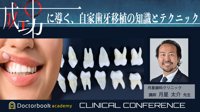 成功に導く自家歯牙移植の知識とテクニック | Doctorbook academy