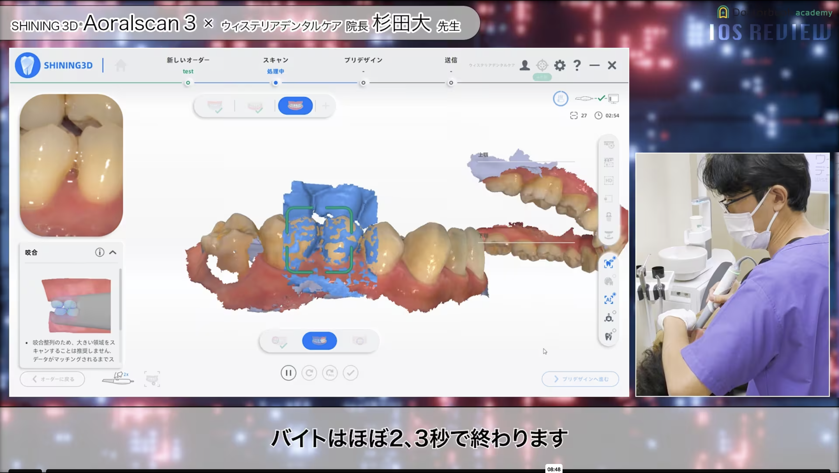 【口腔内スキャナー比較動画】第6弾 〜SHINING3D社 AORALSCAN 3〜
