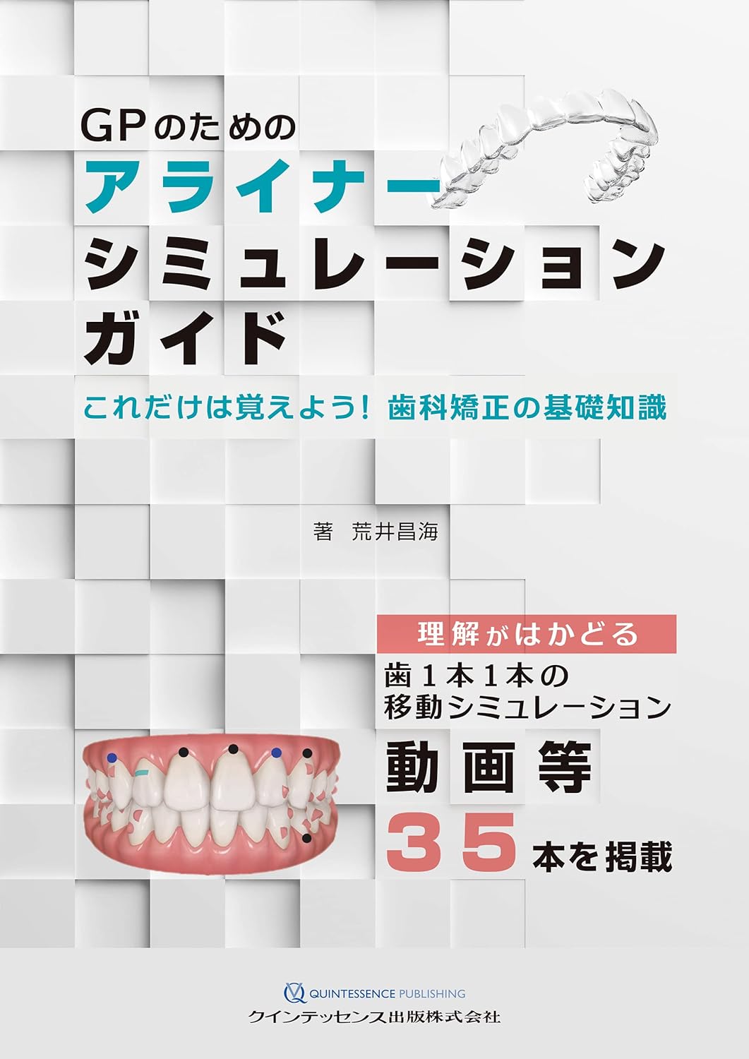 【裁断済み】GPのための咬合誘導 : 効果的な歯列拡大と床矯正の限界