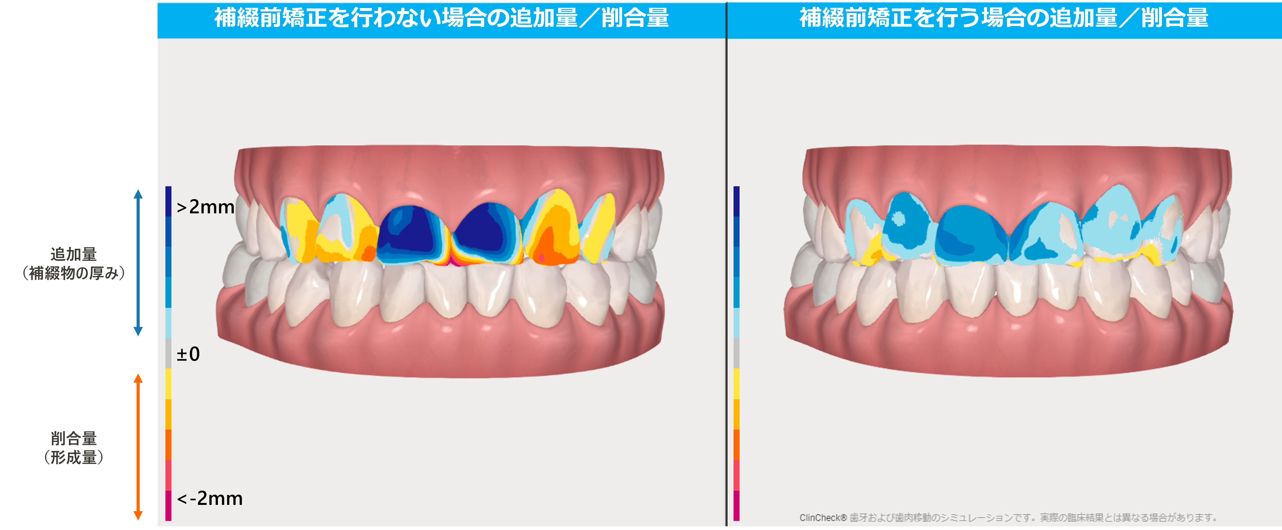 矯正と補綴の治療計画をシームレスに。 | Doctorbook academy 