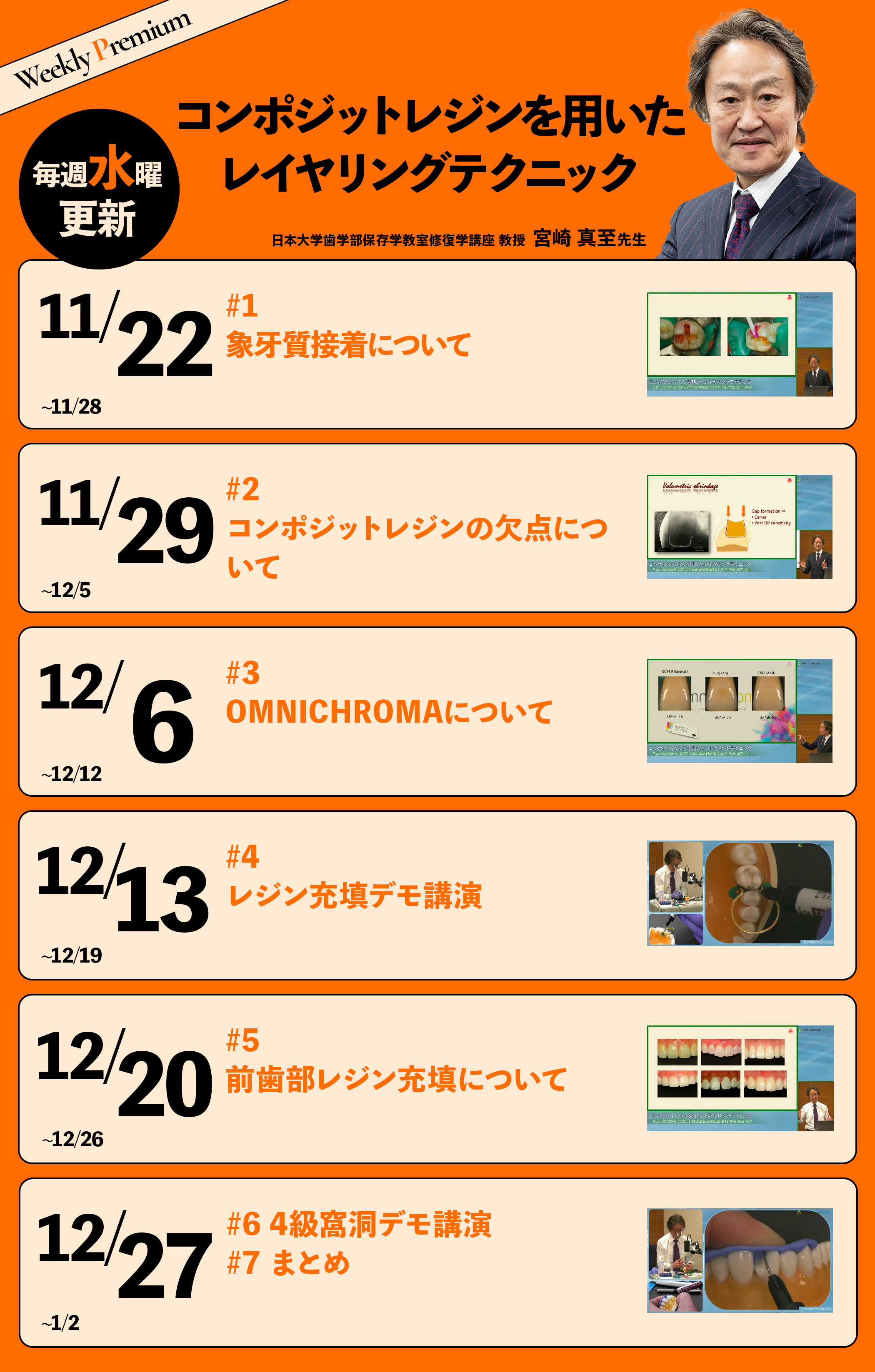 schedule_コンポジットレジンを用いたレイヤリングテクニック
