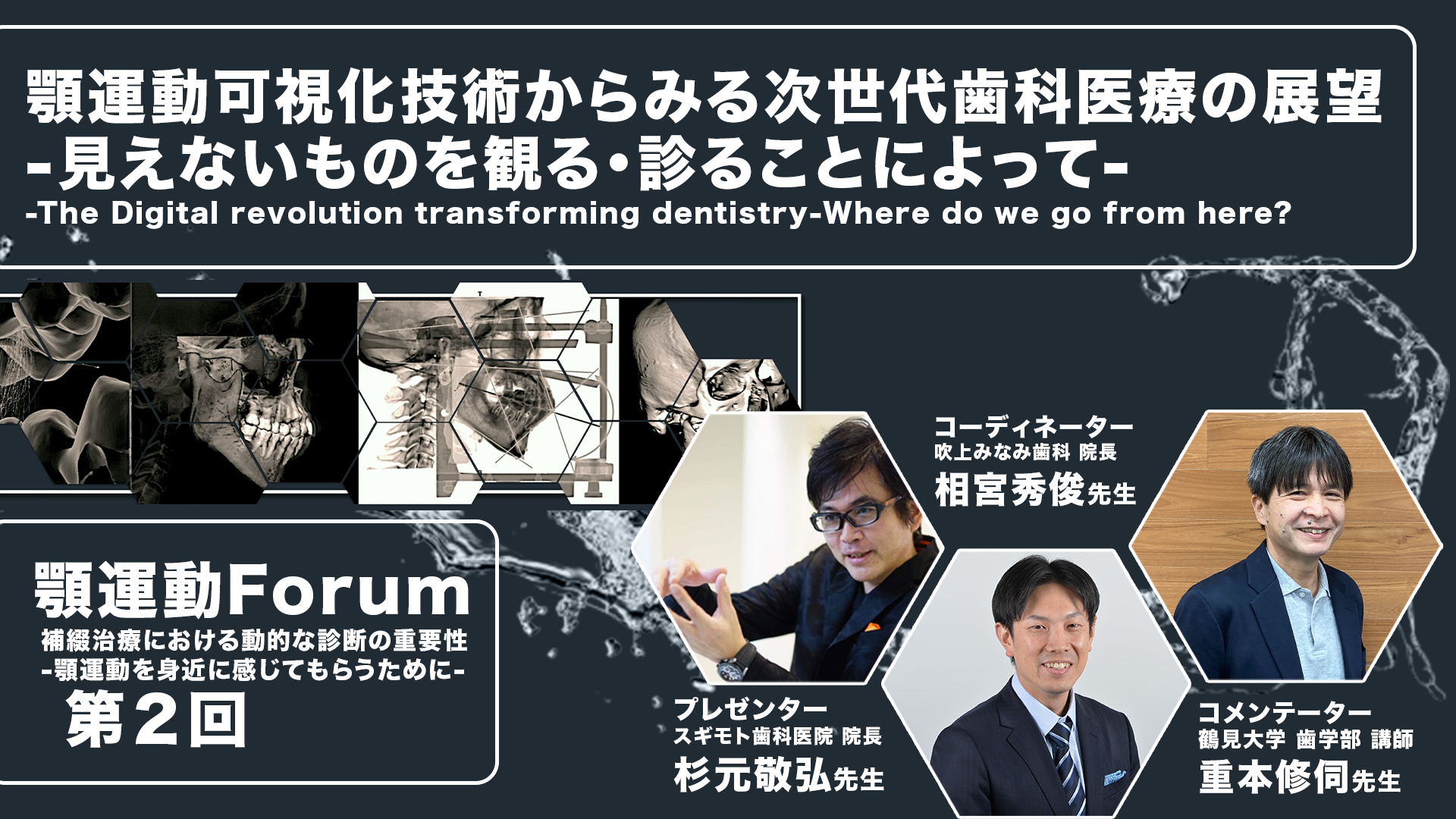 第2回 顎運動可視化技術からみる次世代歯科医療の展望 -みえないものを観る・診ることによって-