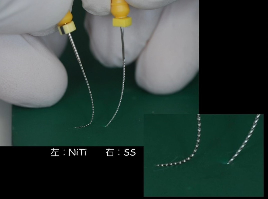 Evidence u0026 TechniqueNiTiロータリーファイルを効果的に使う実践歯