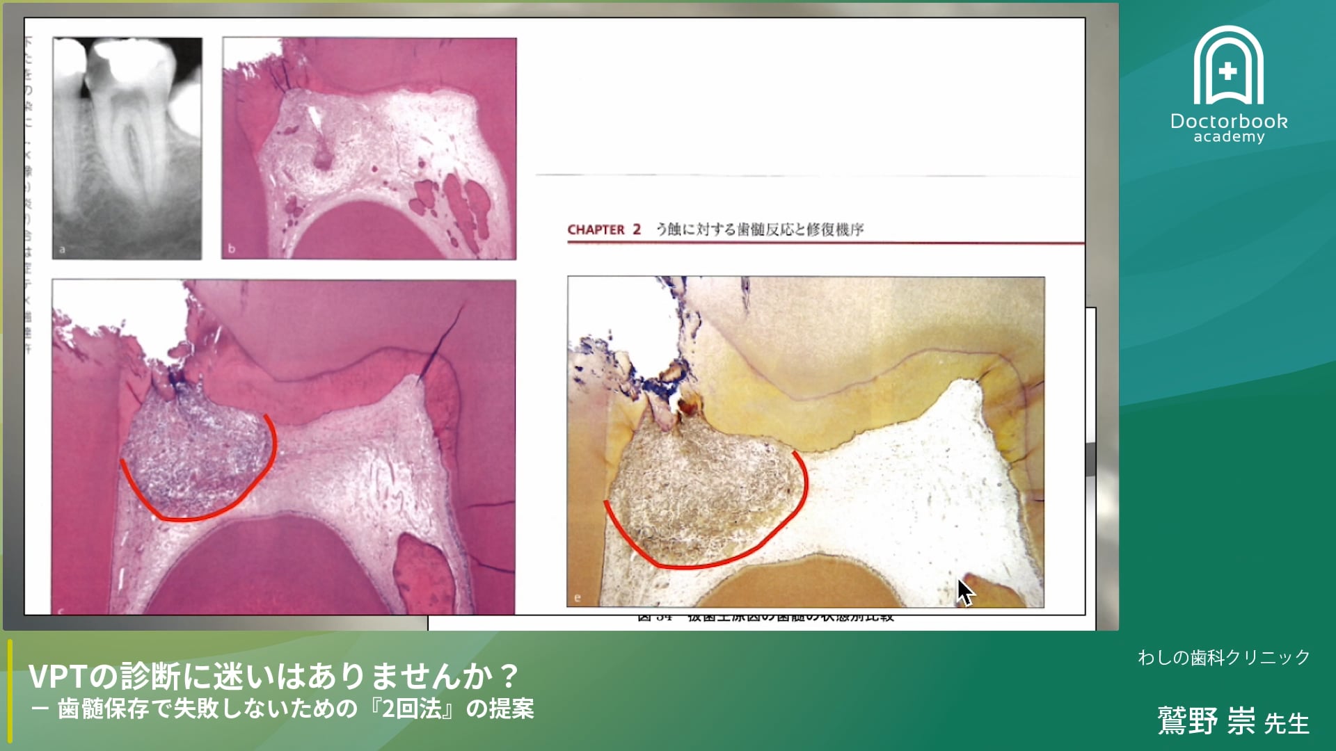 鷲野先生Part5