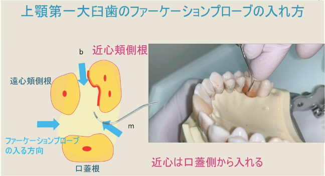 動画でスキルアップ】DHかっきーのシャープニング&SRPセミナー 後半