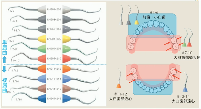 歯科衛生士 手用スケーラー プローブ DH 歯科医師 キュレット シックル