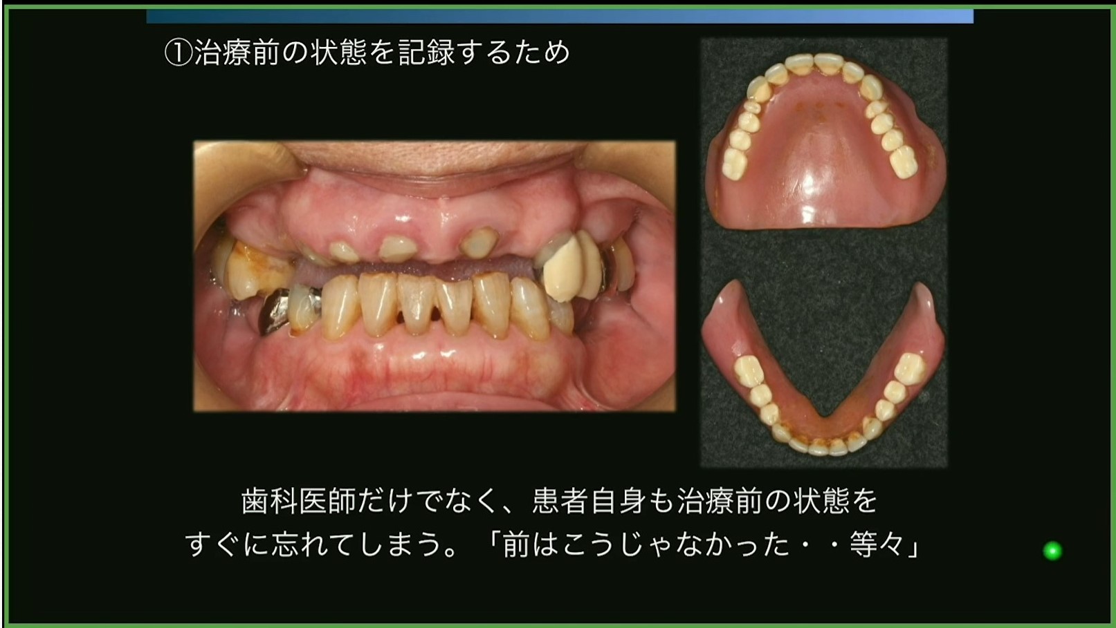 臨床歯科医のための補綴前矯正治療の実際-