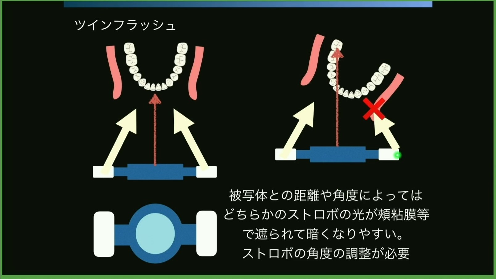 入門 歯科臨床における写真撮影 写真とカメラの基礎知識 松田謙一先生 Doctorbook Academy