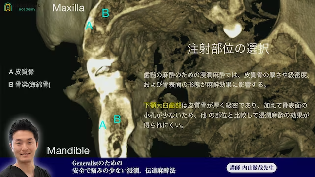 ④Generalistのための安全で痛みの少ない浸潤、伝達麻酔法