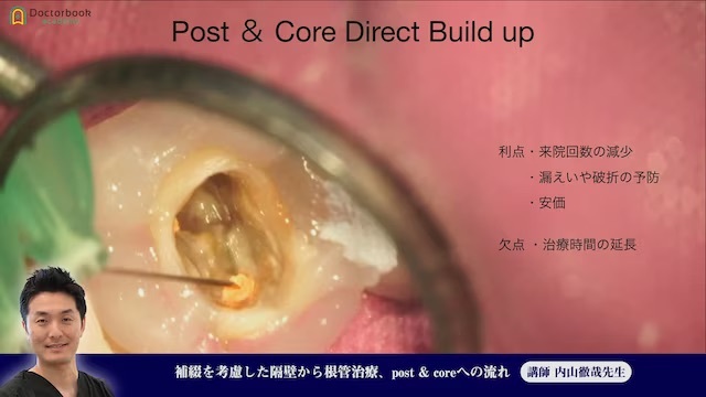 ⑨補綴を考慮した隔壁から根管治療、post & coreへの流れ