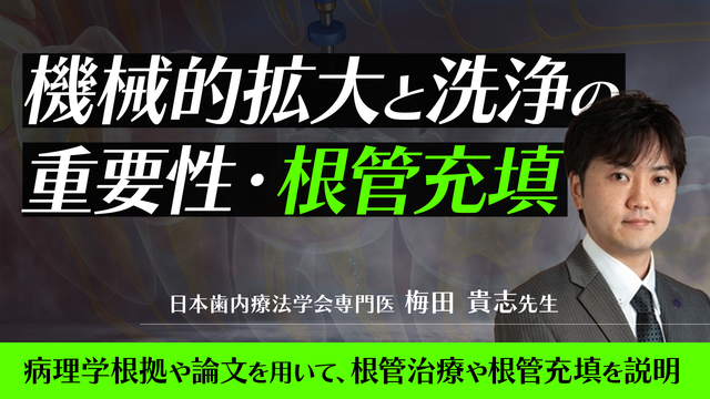機械的拡大と洗浄の重要性・根管充填