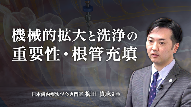 機械的拡大と洗浄の重要性・根管充填