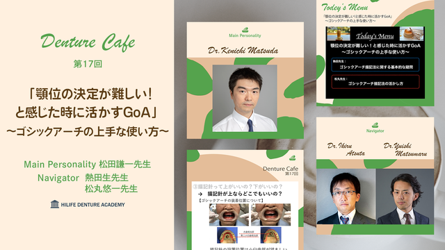 顎位の決定が難しい！と感じた時に活かすGoA 〜ゴシックアーチの上手な使い方～ │ Denture Cafe 第17回　