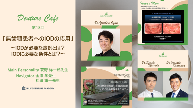 無歯顎患者へのIODの応用 〜IODが必要な症例とは？ IODに必要な条件とは？〜│Denture Cafe 第18回