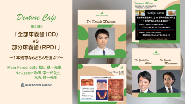 全部床義歯（CD）vs 部分床義歯（RPD） 〜1本残存ならどちらを選ぶ？～│DentureCafe 第20回