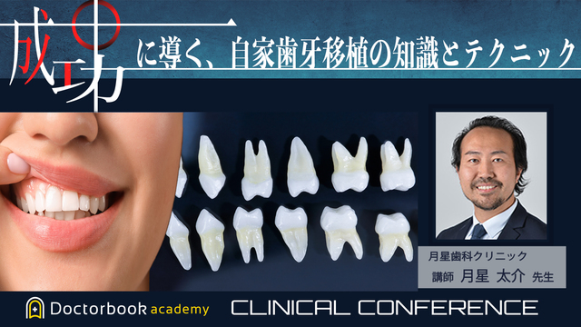 成功に導く自家歯牙移植の知識とテクニック