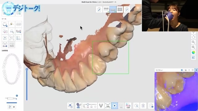 IOS編｜デジトーク！～デジタルデンティストリーの現在と未来を多彩なゲストを呼んで語り合うトーク番組～