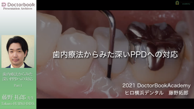 歯内療法からみた深いPPDへの対応