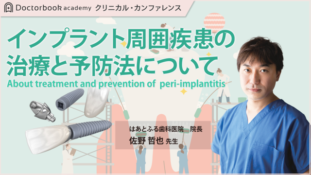 インプラント周囲疾患の治療と予防について | Doctorbook academy
