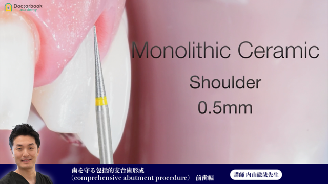 ⑱歯を守る包括的支台歯形成(comprehensive abutment procedure) 前歯編