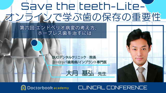 Save the teeth−Lite−オンラインで学ぶ歯の保存の重要性 「 第六回：エンドペリオ病変の考え方，ホープレス歯を治すには」