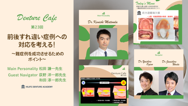 前後すれ違い症例への対応を考える！ ～難症例を成功させるためのポイント～│Denture Cafe 第23回 