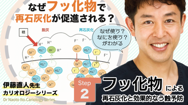 フッ化物による再石灰化と効果的なう蝕予防（全15回）│伊藤直人先生 カリオロジーシリーズ Step2