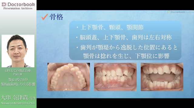 歯科矯正治療と顎顔面矯正治療 - 健康/医学