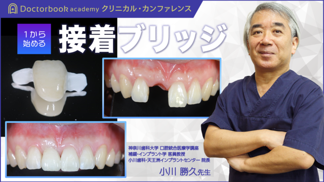 1から始める接着ブリッジ | Doctorbook academy (ドクターブック