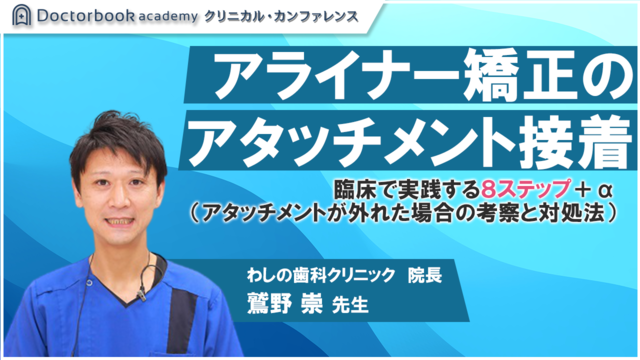 アライナー矯正のアタッチメント接着 - 臨床で実践する８ステップ＋α （アタッチメントが外れた場合の考察と対処法）