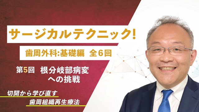 サージカルテクニック！ 歯周外科：基礎編 第5回 根分岐部病変への挑戦