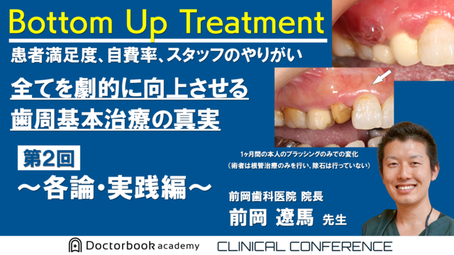 Bottom Up Treatment　患者満足度、自費率、スタッフのやりがい　全てを劇的に向上させる歯周基本治療の真実　第2回～各論・実践編～