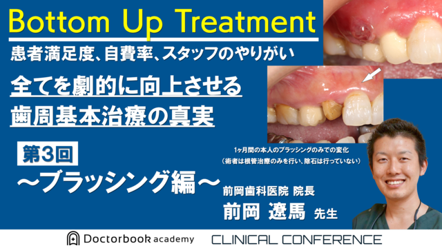 Bottom Up Treatment　患者満足度、自費率、スタッフのやりがい　全てを劇的に向上させる歯周基本治療の真実　第3回～ブラッシング編～