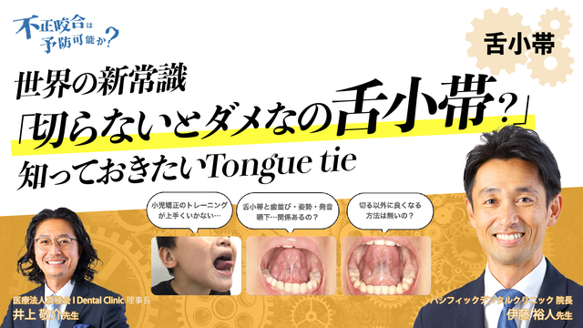 不正咬合は予防可能か?〜 睡眠の視点を小児口腔発達に役立てる 不正咬合は予防可能か?〜 睡眠の視点を小児口腔発達に役立てる