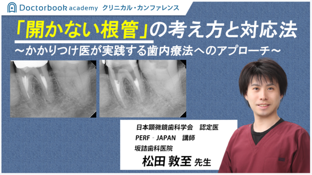 「開かない根管」「治らない根管」の考え方と対応法～かかりつけ医が実践する歯内療法のアプローチ〜