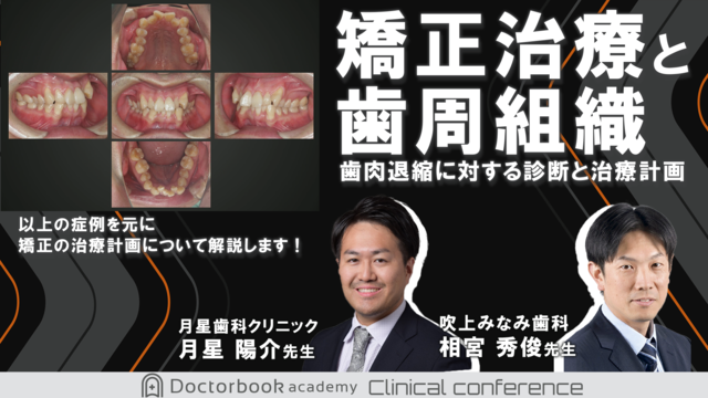 矯正治療と歯周組織　歯肉退縮に対する診断と治療計画