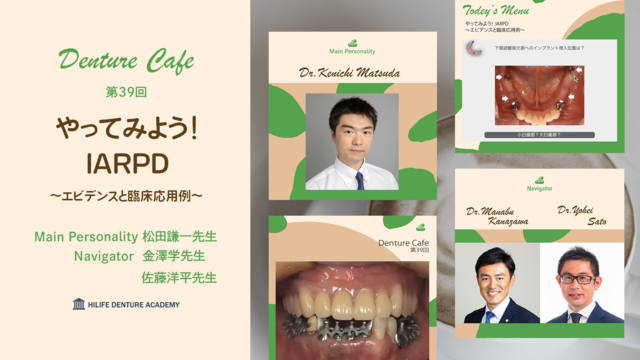 やってみよう！ IARPD　〜エビデンスと臨床応用例〜│Denture Cafe 第39回