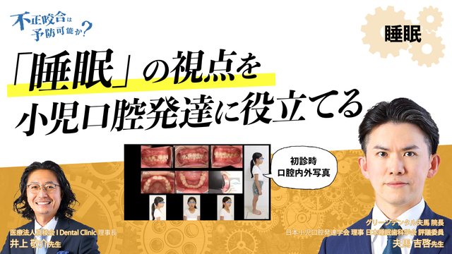 不正咬合は予防可能か?〜 睡眠の視点を小児口腔発達に役立てる 不正咬合は予防可能か?〜 睡眠の視点を小児口腔発達に役立てる