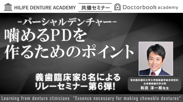 噛めるPD（パーシャルデンチャー）を作るポイント【〜義歯臨床家に学ぶ〜噛める義歯製作に必要なエッセンス 第6弾】